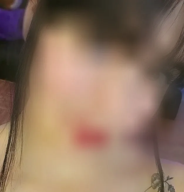 Esra, 28